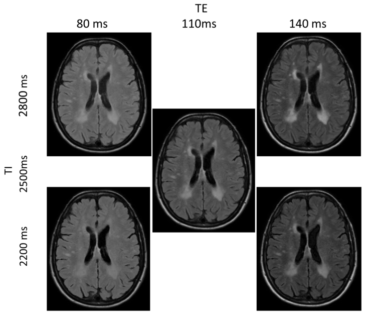 Simulation of MR images