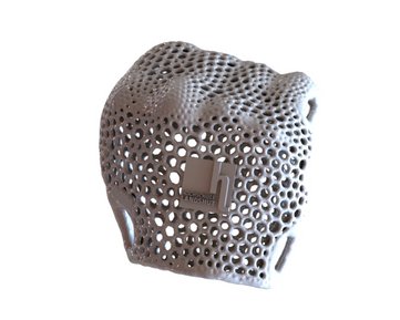 Handorthese aus 3D Drucker