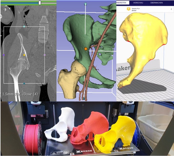 3D printing